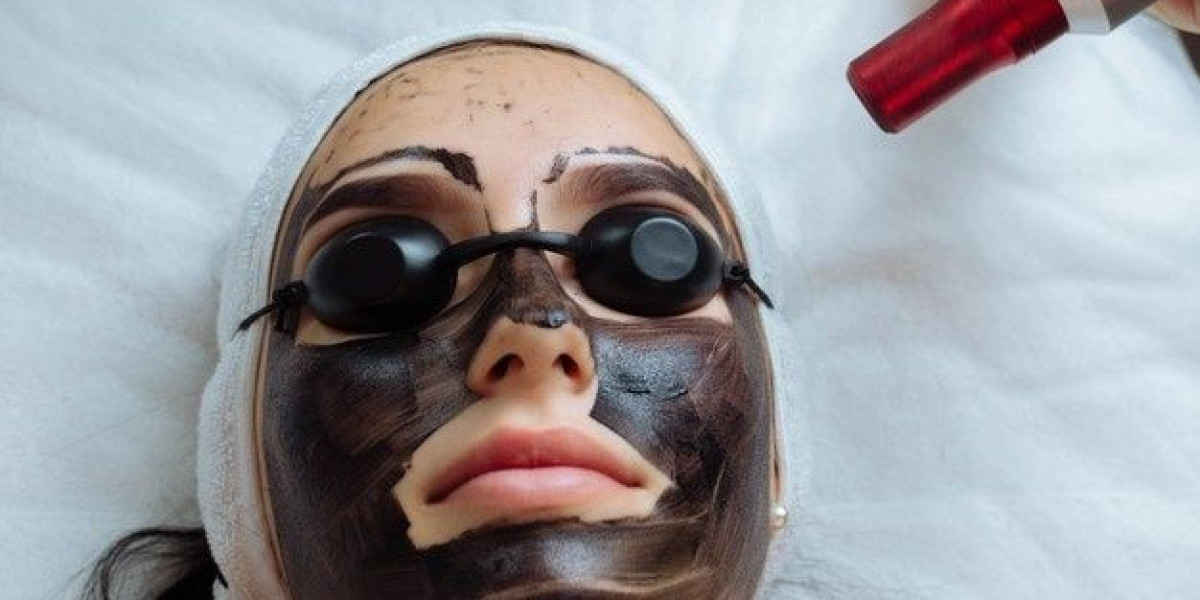 Redefine Skin Clarity with Precision Carbon Therapy