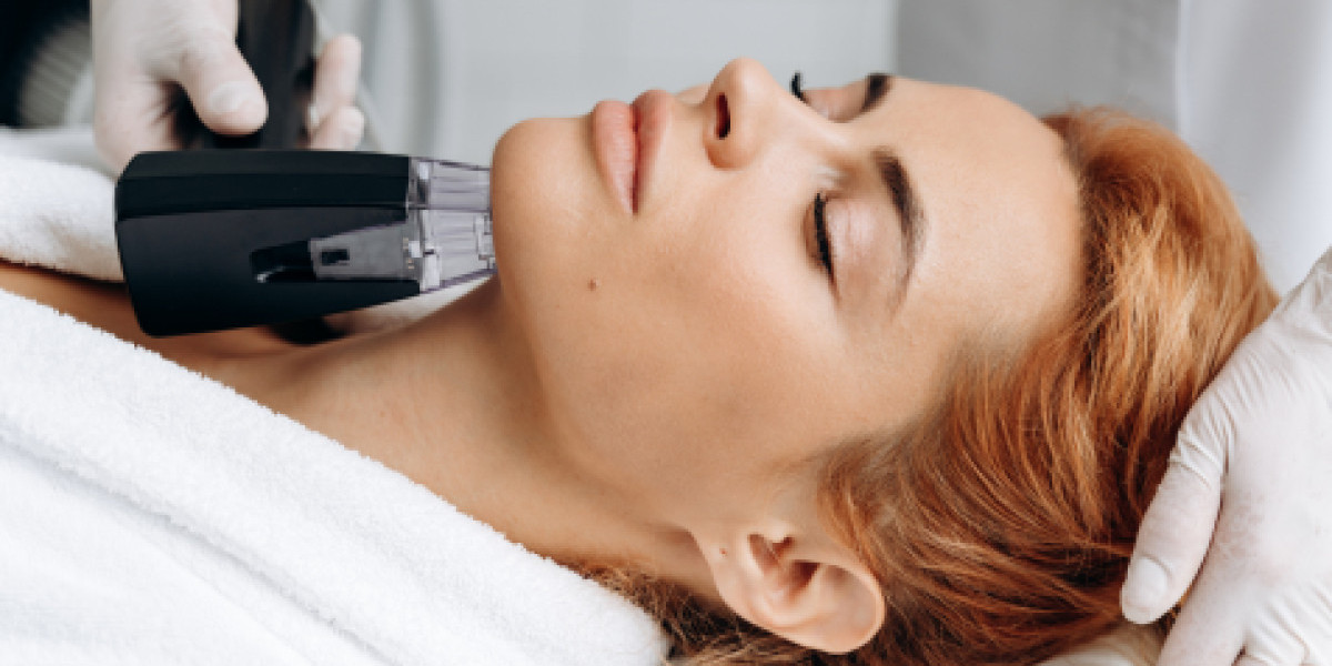Morpheus8 for Acne Scars Does It Really Work?